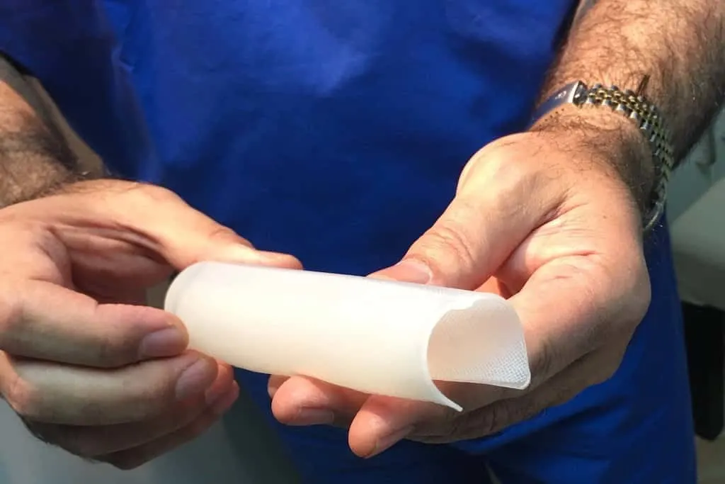 Does the Penuma Implant Increase Erect Penis Length?
